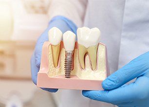 Learn More About Dental Implants Dental implant model