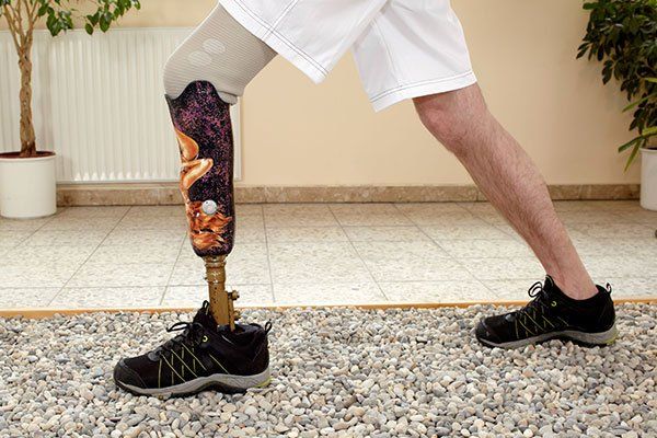 prosthetic device