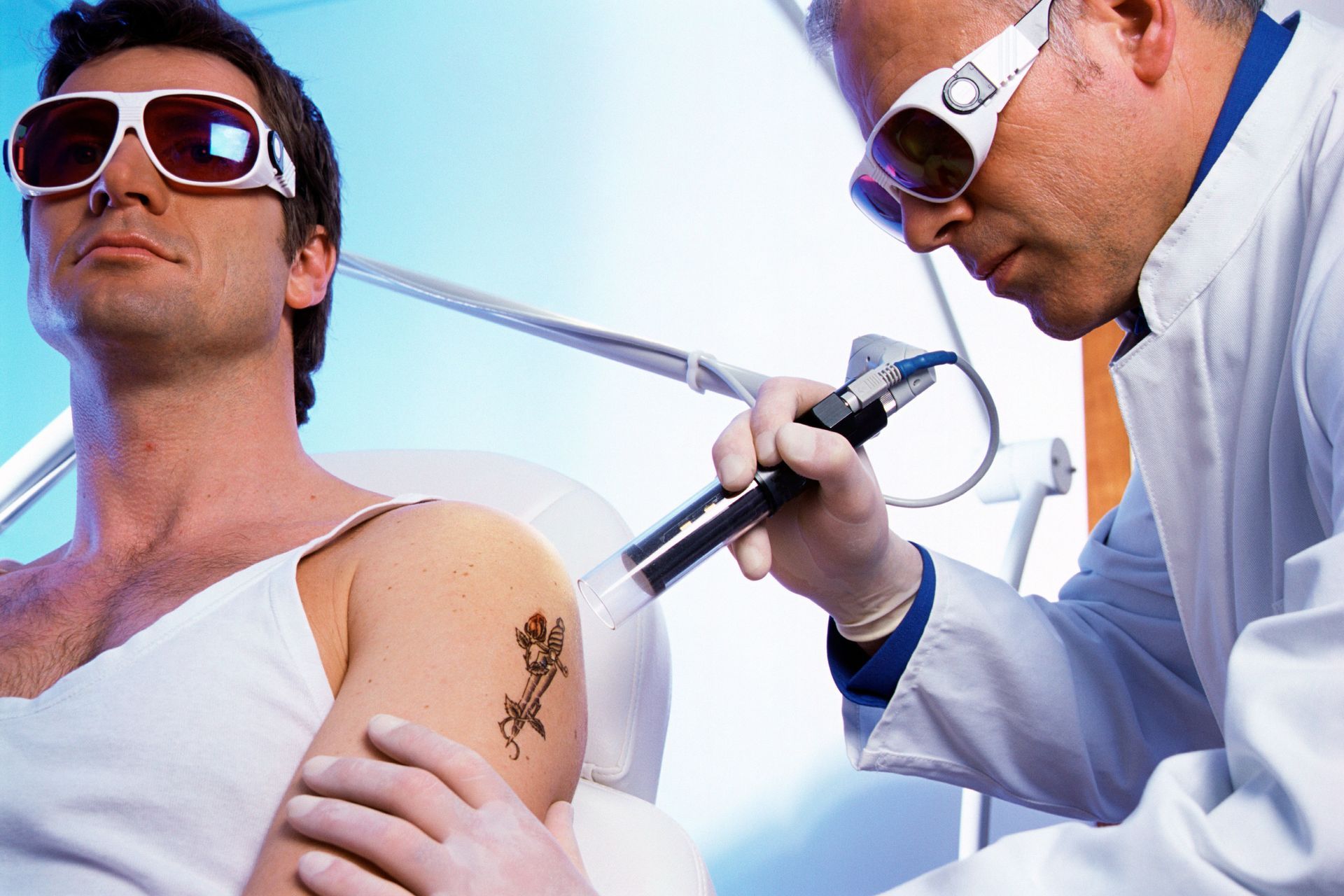 tattoo removal