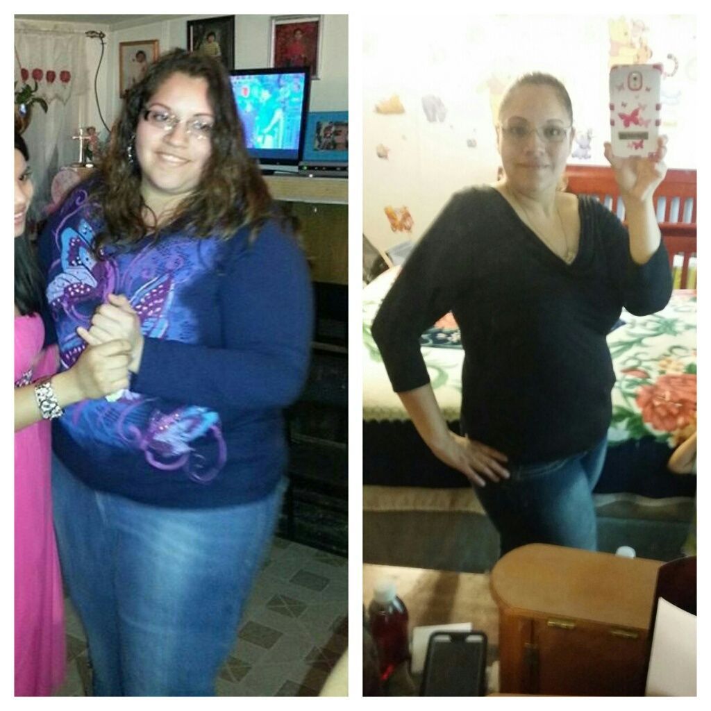Before and after weight loss: woman in casual clothes, smiling, posing in home setting.