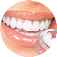 Closeup of white teeth