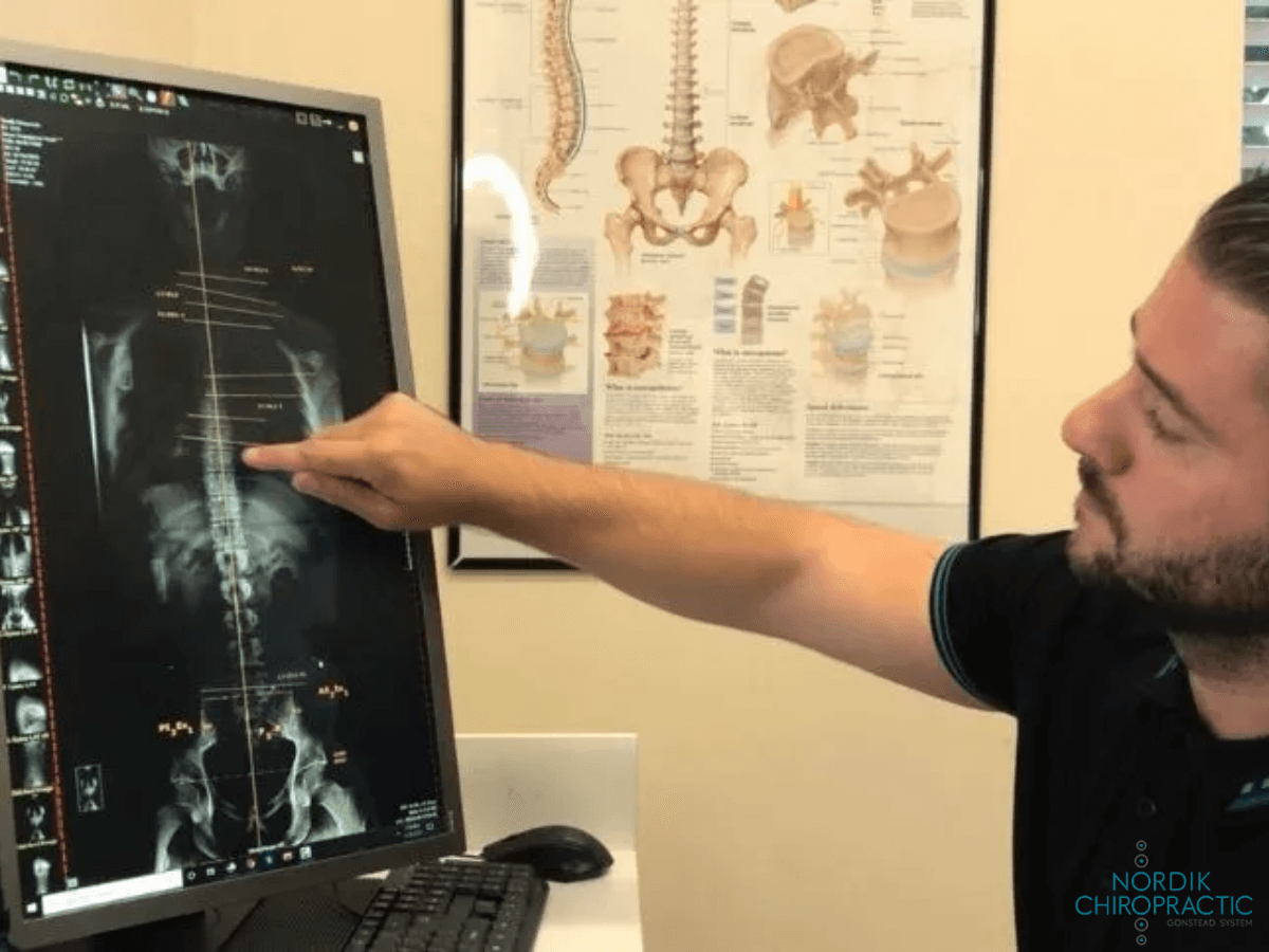 Man pointing at a spine X-ray on a monitor in a medical office