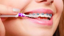 Learn More About Common Orthodontic Problems Orthodontic care