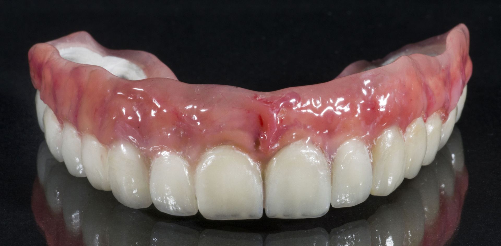dentures