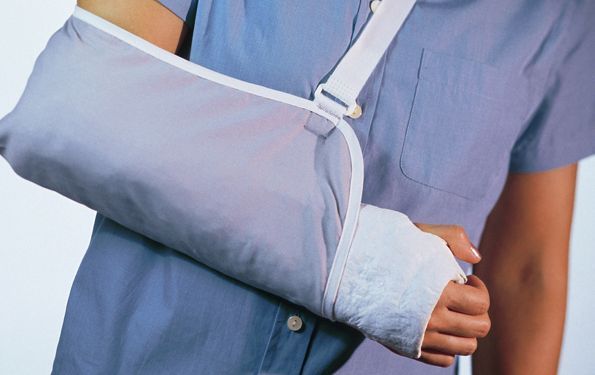 A person with a cast on their arm is wearing a sling.