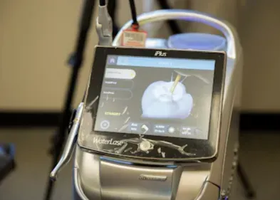 Dental laser device screen showing a tooth with an animated treatment, in an office setting.