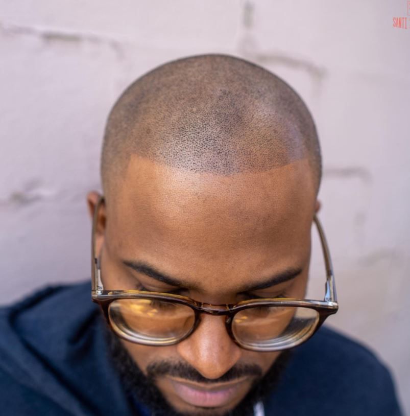 A man wearing glasses has a shaved head