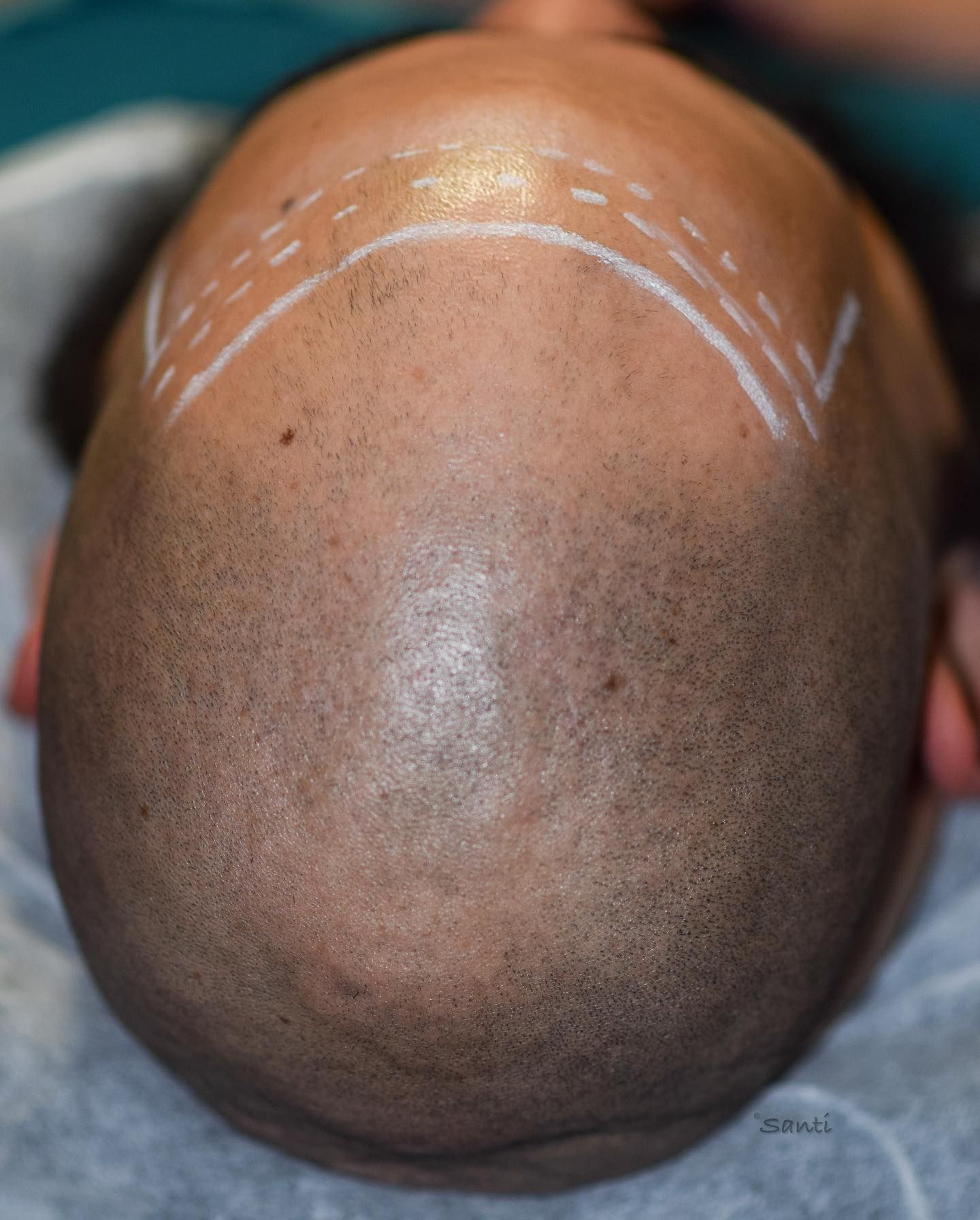 A close up of a man 's head with a drawing on it.