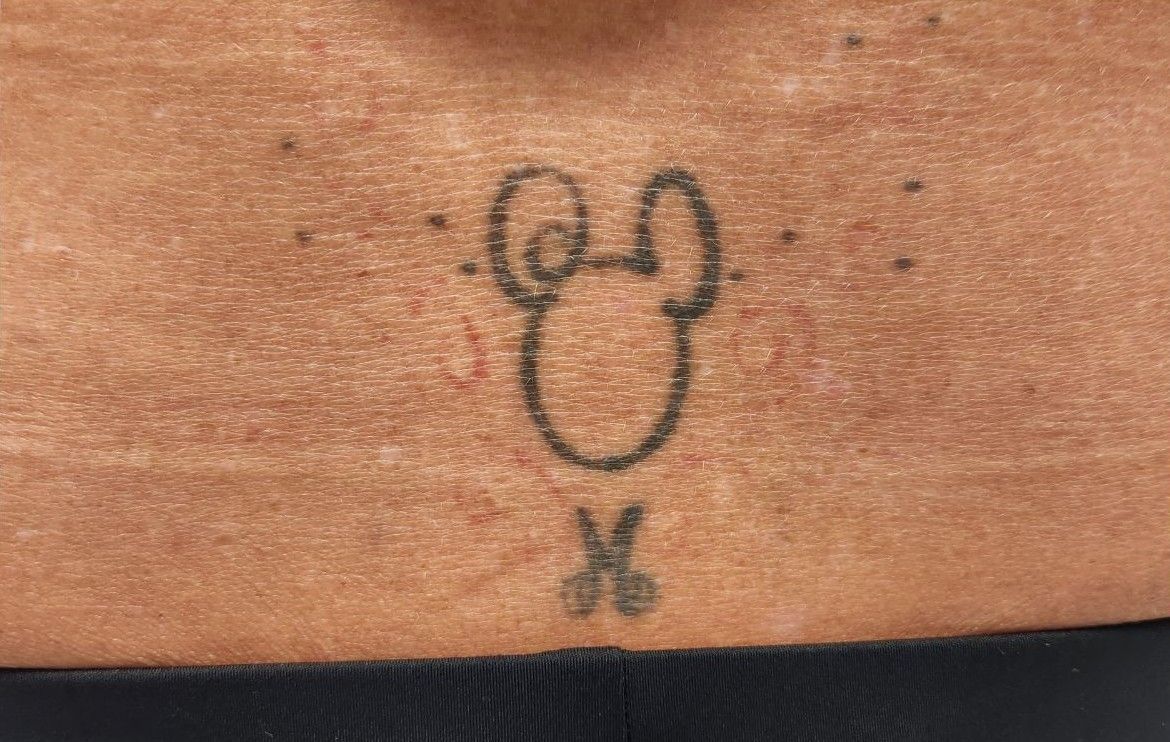 Close-up of skin with a faded black tattoo of a stylized mouse face and bow tie.
