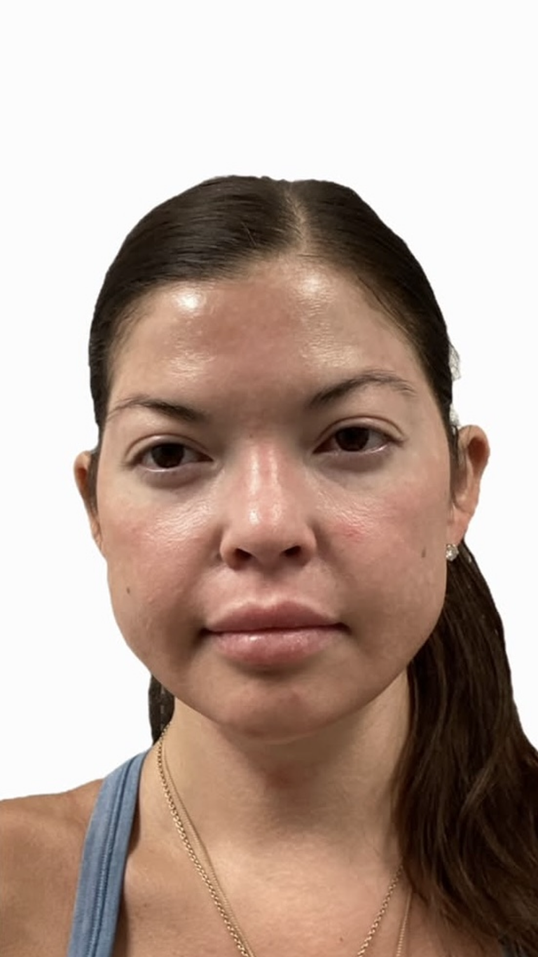 Woman with dark hair looking at the camera, wearing a blue top, with a neutral expression.