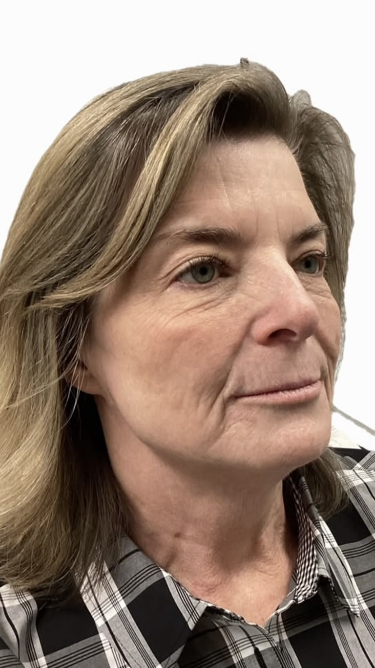 Woman with light brown hair in a plaid shirt. She is looking slightly to the right with a neutral expression.