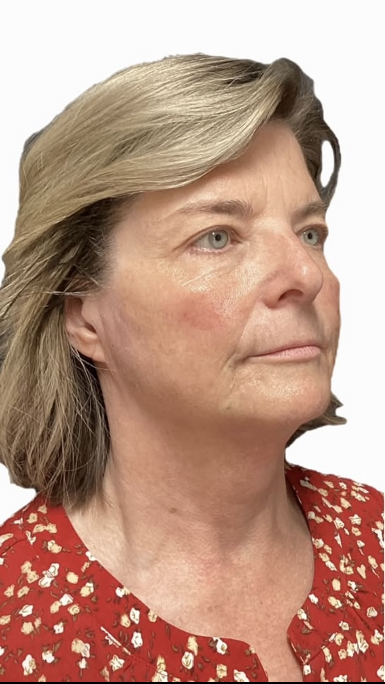 Woman with blonde hair wearing red patterned shirt, looking right.