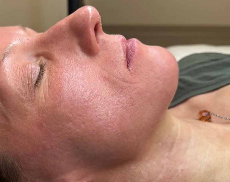 Woman with closed eyes, lying down. Visible skin texture, rosy complexion. 