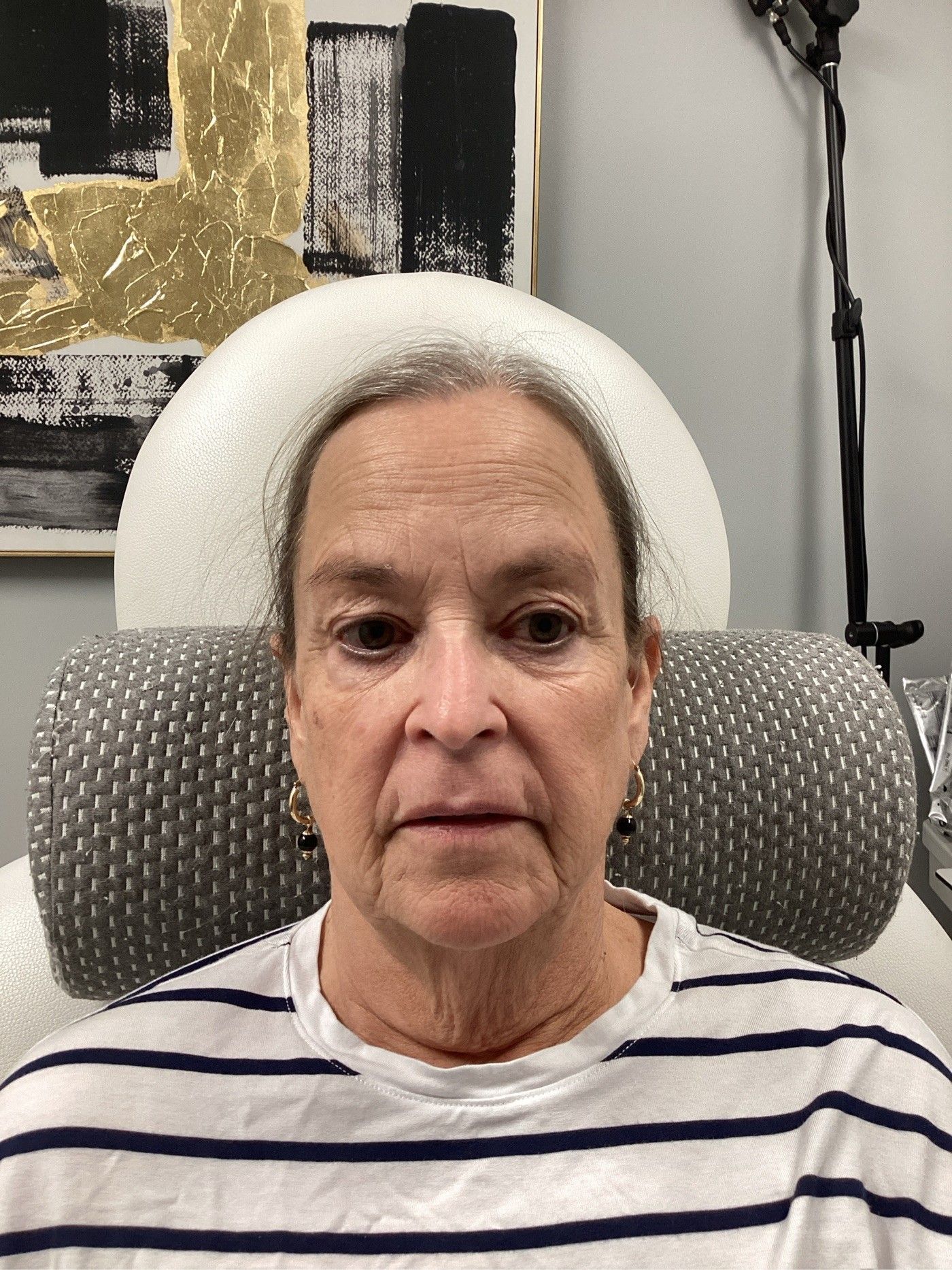 Woman with fair skin in a striped shirt, looking forward, seated. Background with abstract art and white chair.