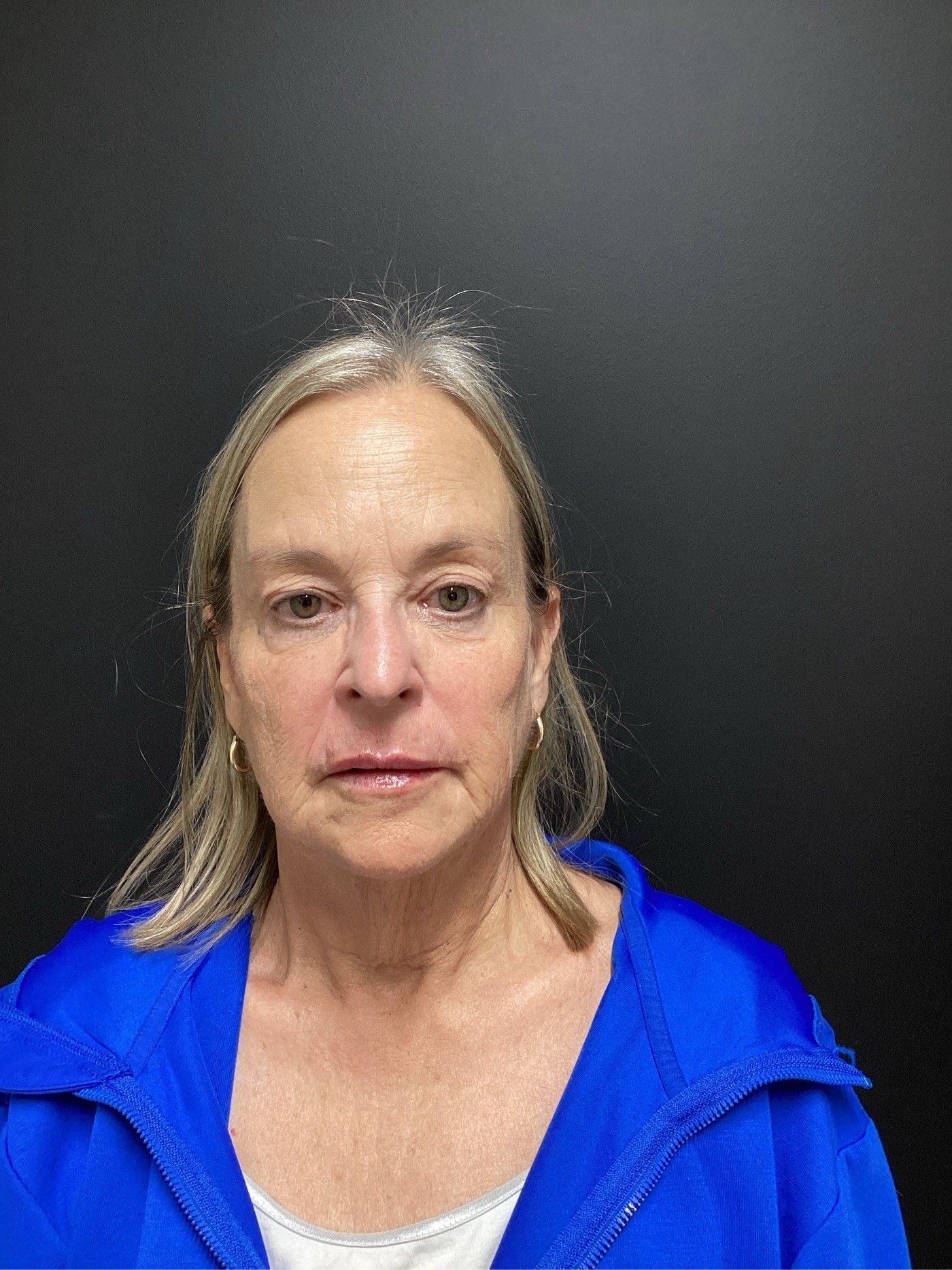 Woman in blue jacket, looking forward, neutral expression, against a dark background.