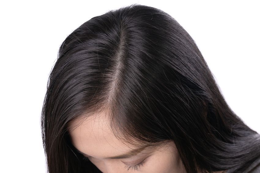 A high-angle close-up of a person's dark hair, showing a center part and visible scalp against a plain white background.