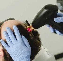 A man is getting a laser hair removal treatment on his head.