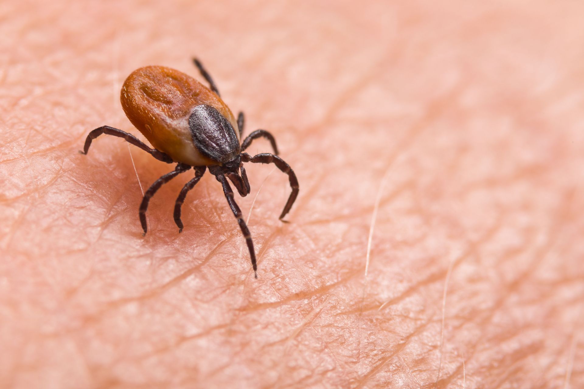 tick removal services