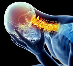Headache and Neck pain