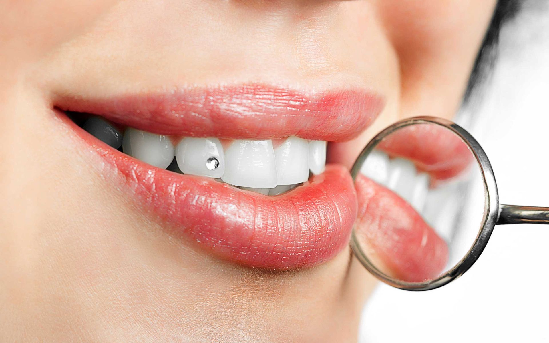 Tooth Gems