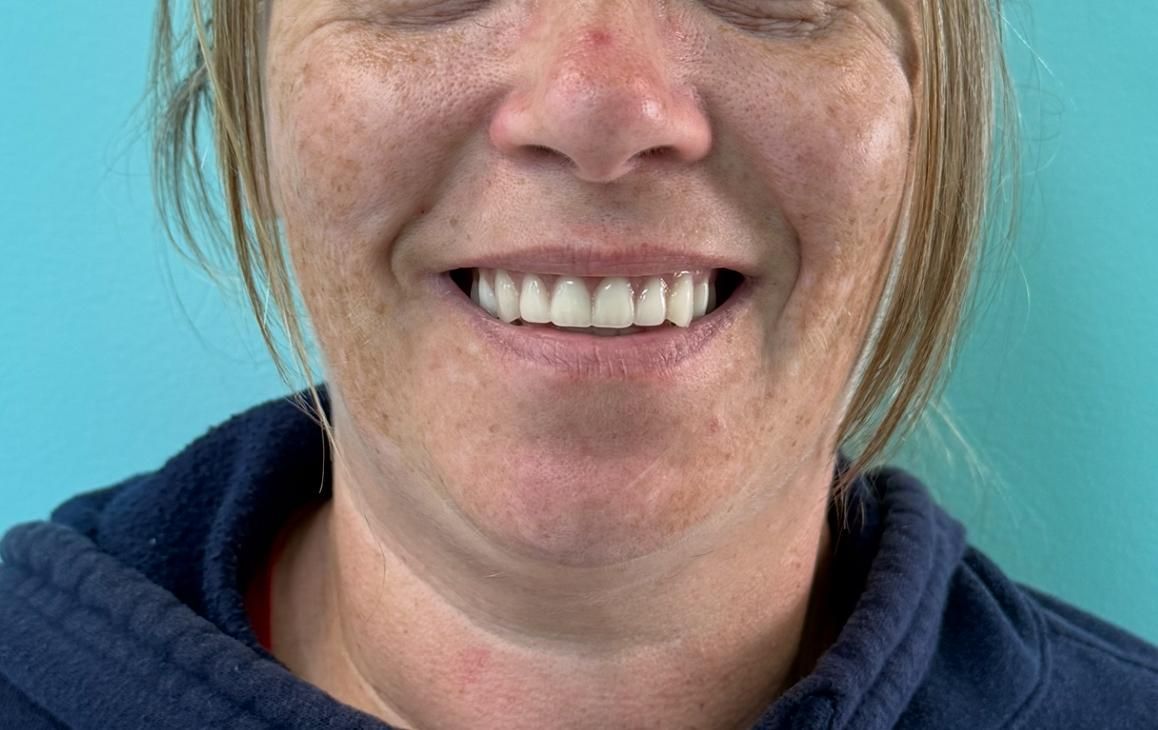 Woman smiling, showing a full set of teeth, against a teal background