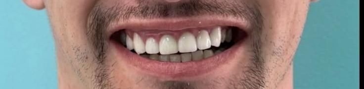 Man smiling, showing off his bright white teeth. He's wearing glasses, and a mustache. Background appears to be a medical setting.