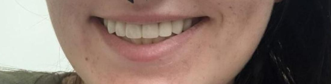 Man smiling, showing off his bright white teeth. He's wearing glasses, and a mustache. Background appears to be a medical setting.