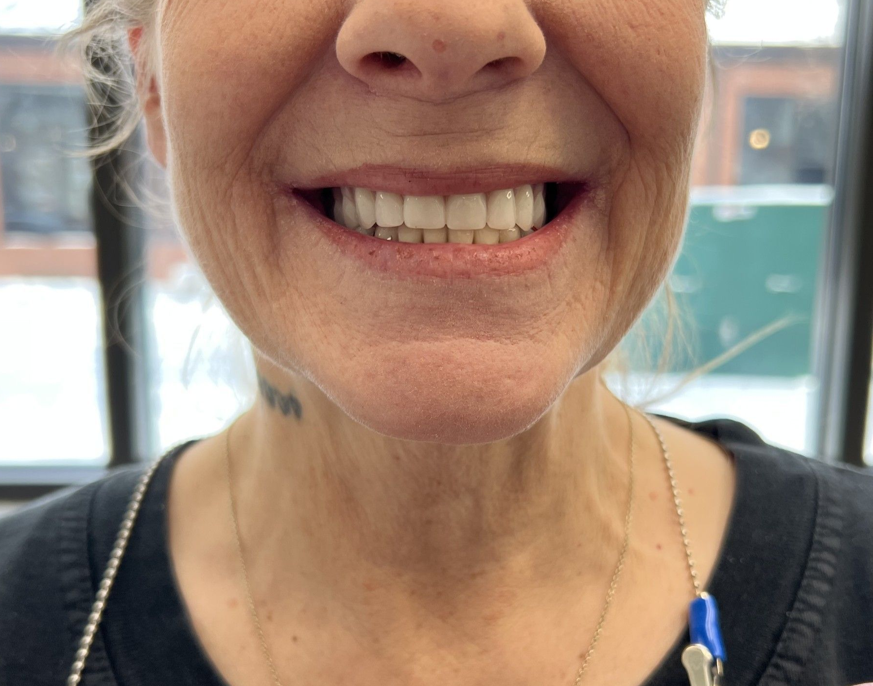 Woman smiling, showing teeth, indoors; wearing dark shirt, pink bib. 
