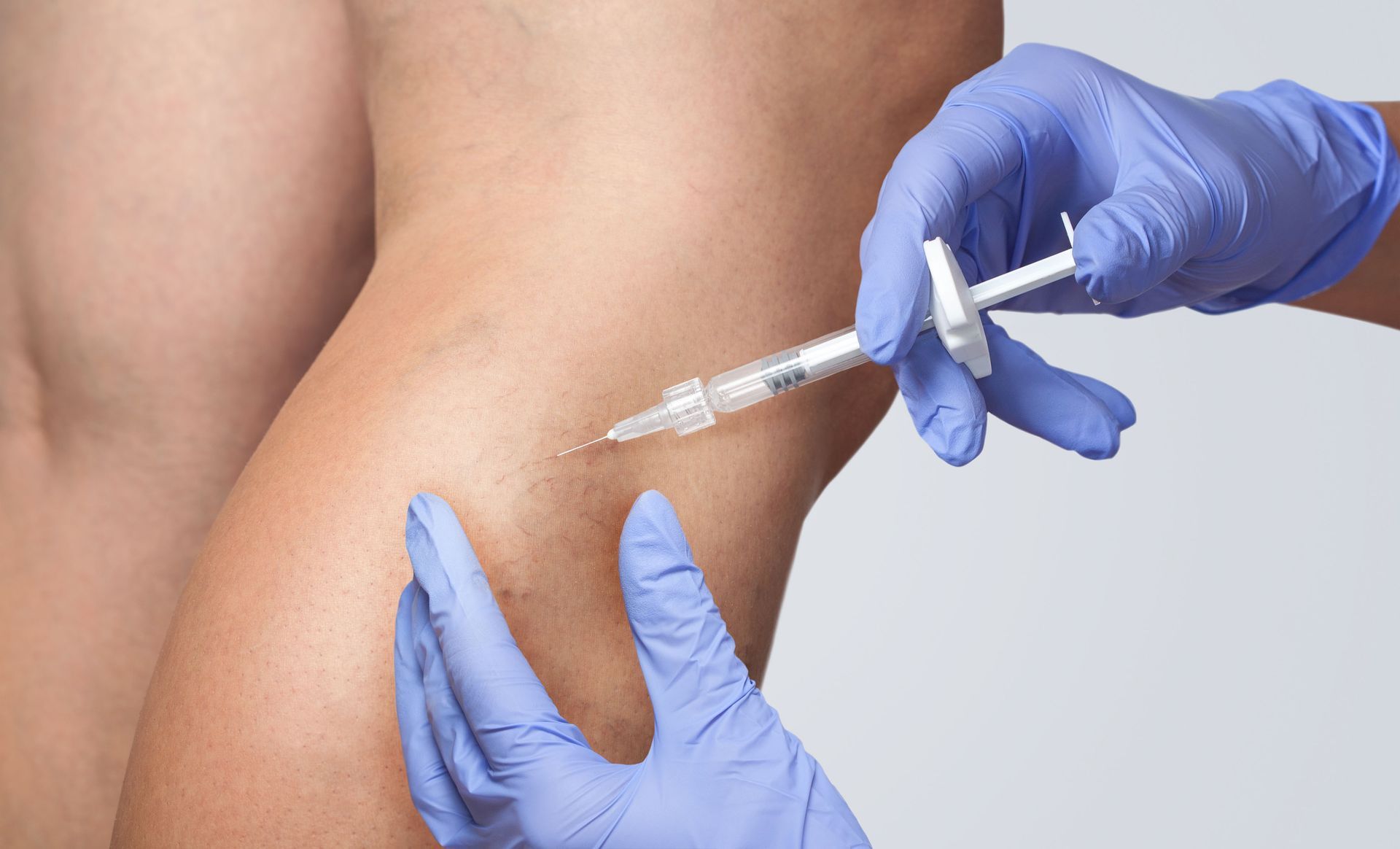 Vascular surgeons
