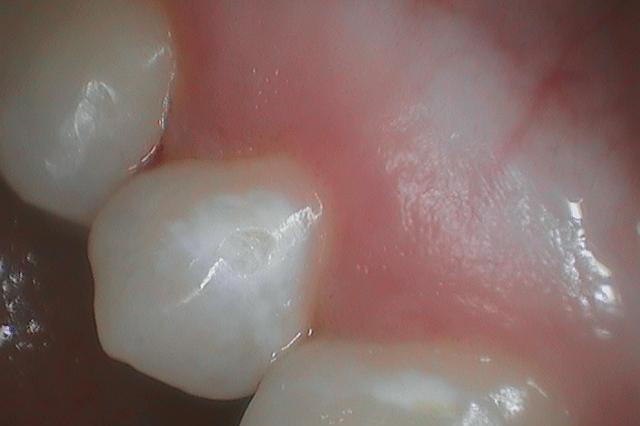 Before General Dentistry