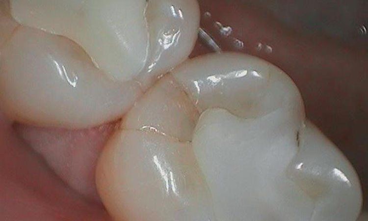 Before General Dentistry