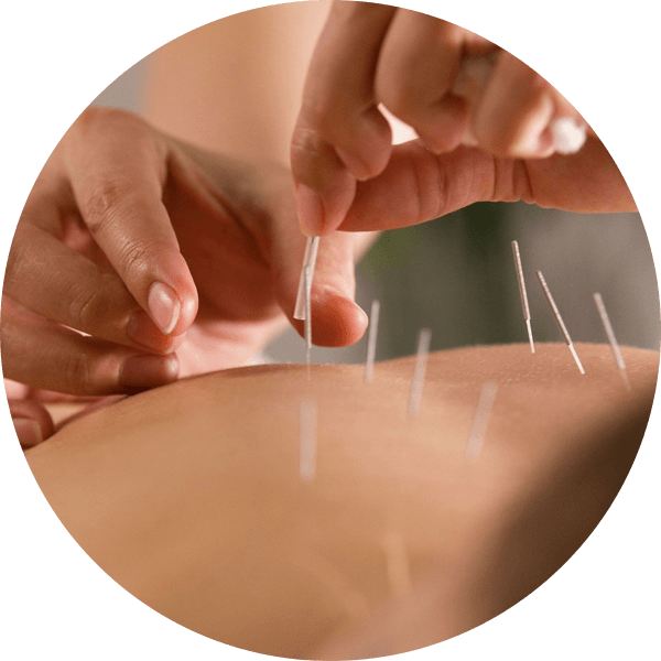 Acupuncture services