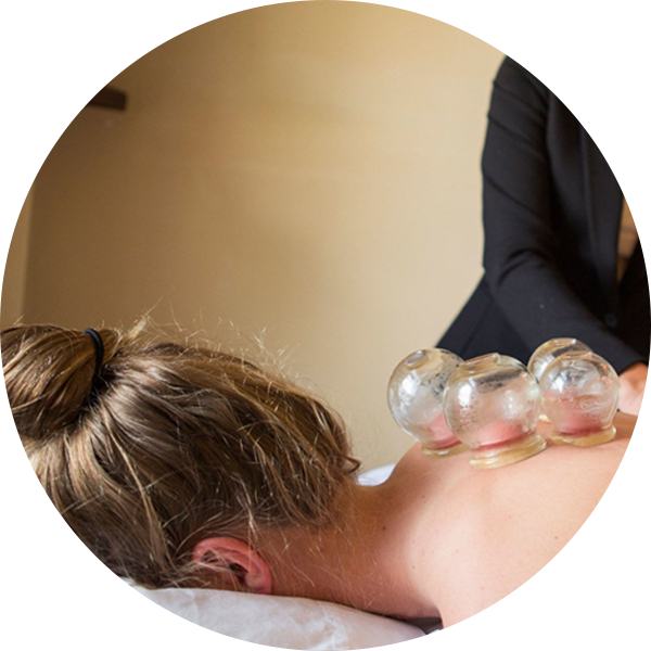 Cupping Therapy