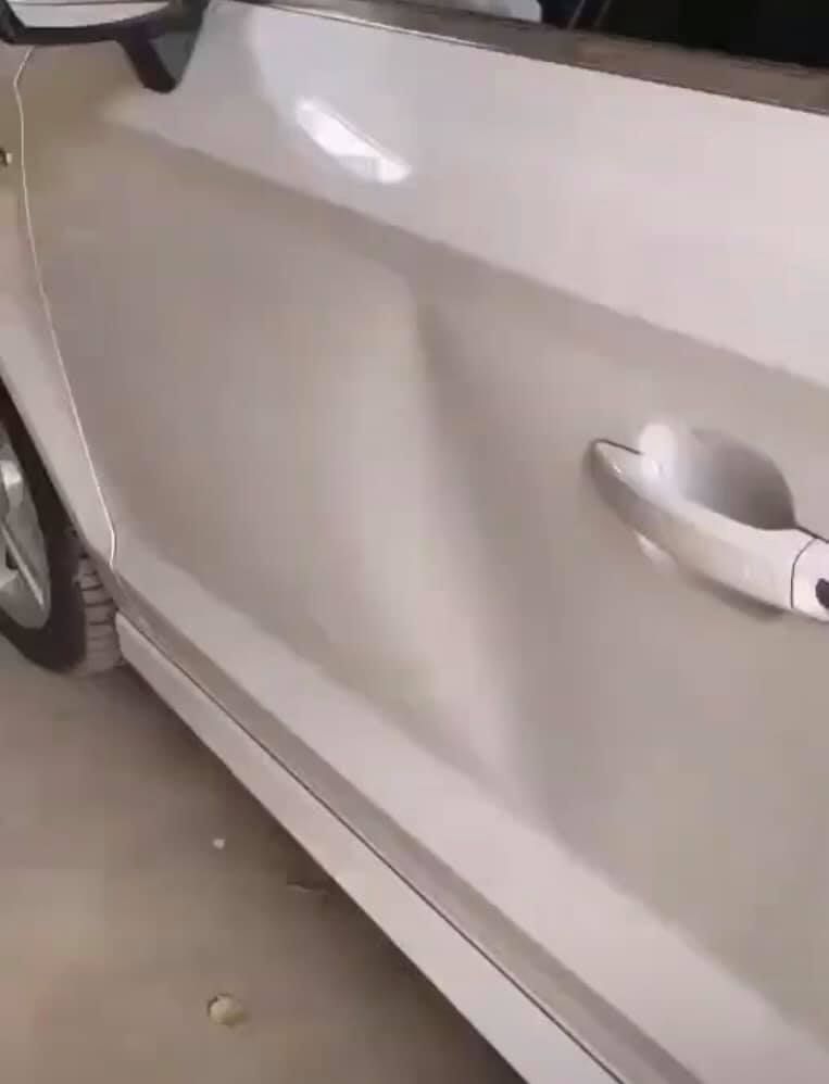 Dent removal