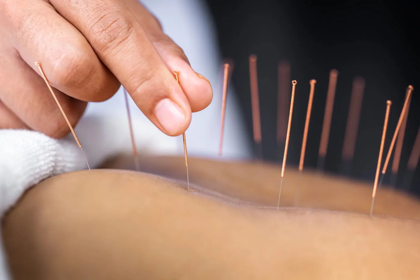 Japanese Style Acupuncture