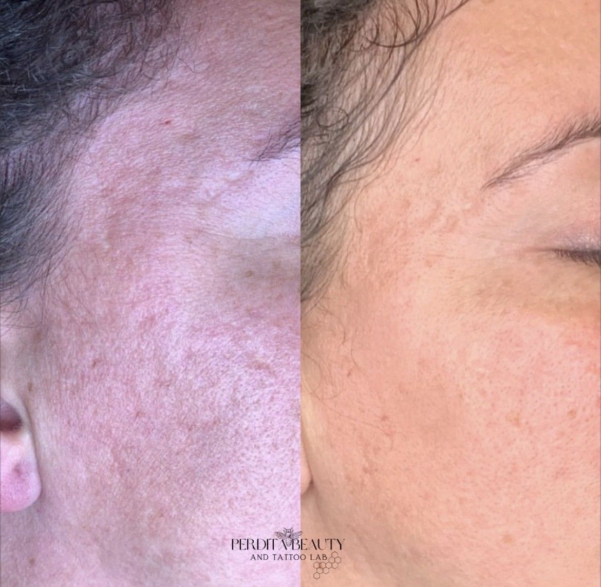 Before-and-after comparison of a person's face. The 