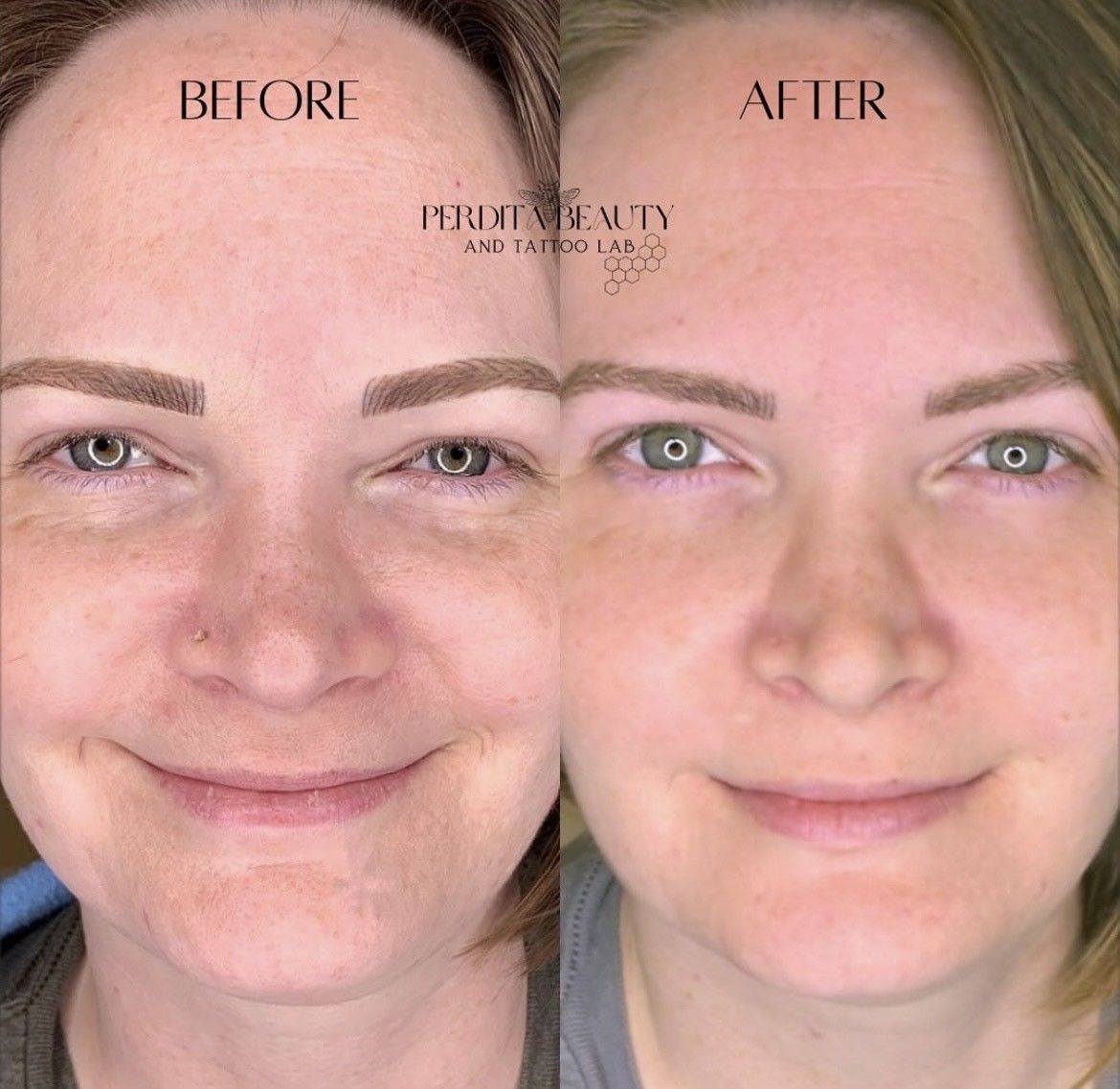 Before-and-after of a woman's face. She smiles; eyebrows & skin appear improved on the right, after.