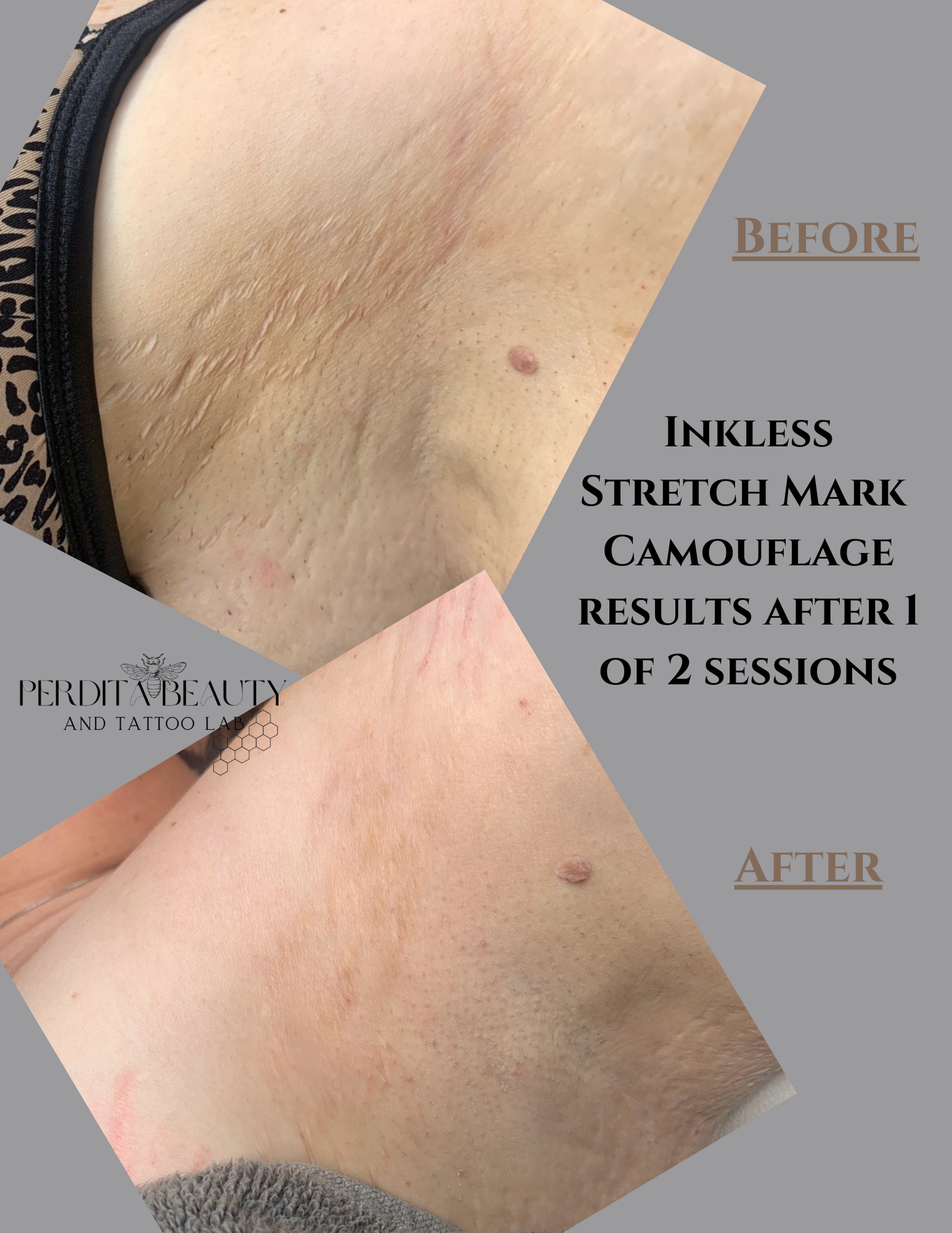 A before and after photo of inkless stretch mark camouflage