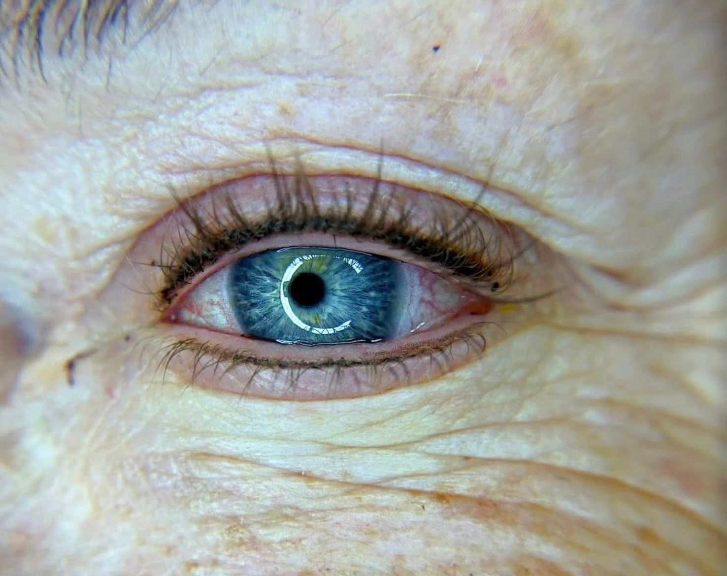 Close-up of a blue eye with wrinkles around it, showing an older person’s skin texture
