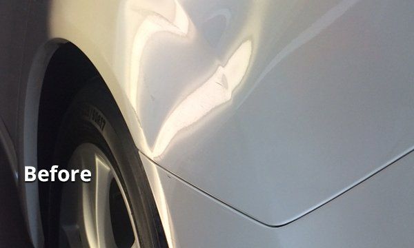 Auto dent removal