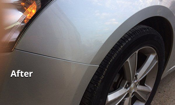 Auto dent removal