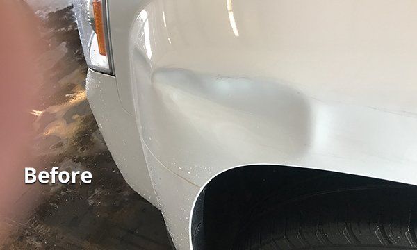 Auto dent removal