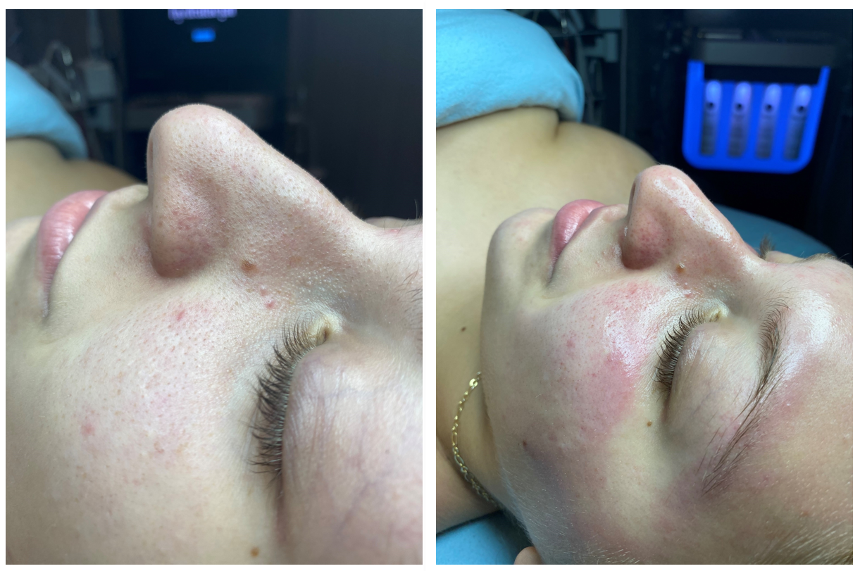 lady laying down with her eyes closed