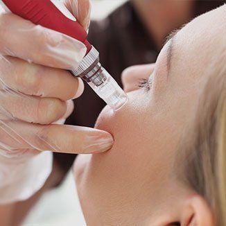 Microneedling