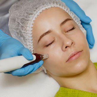 Microneedling