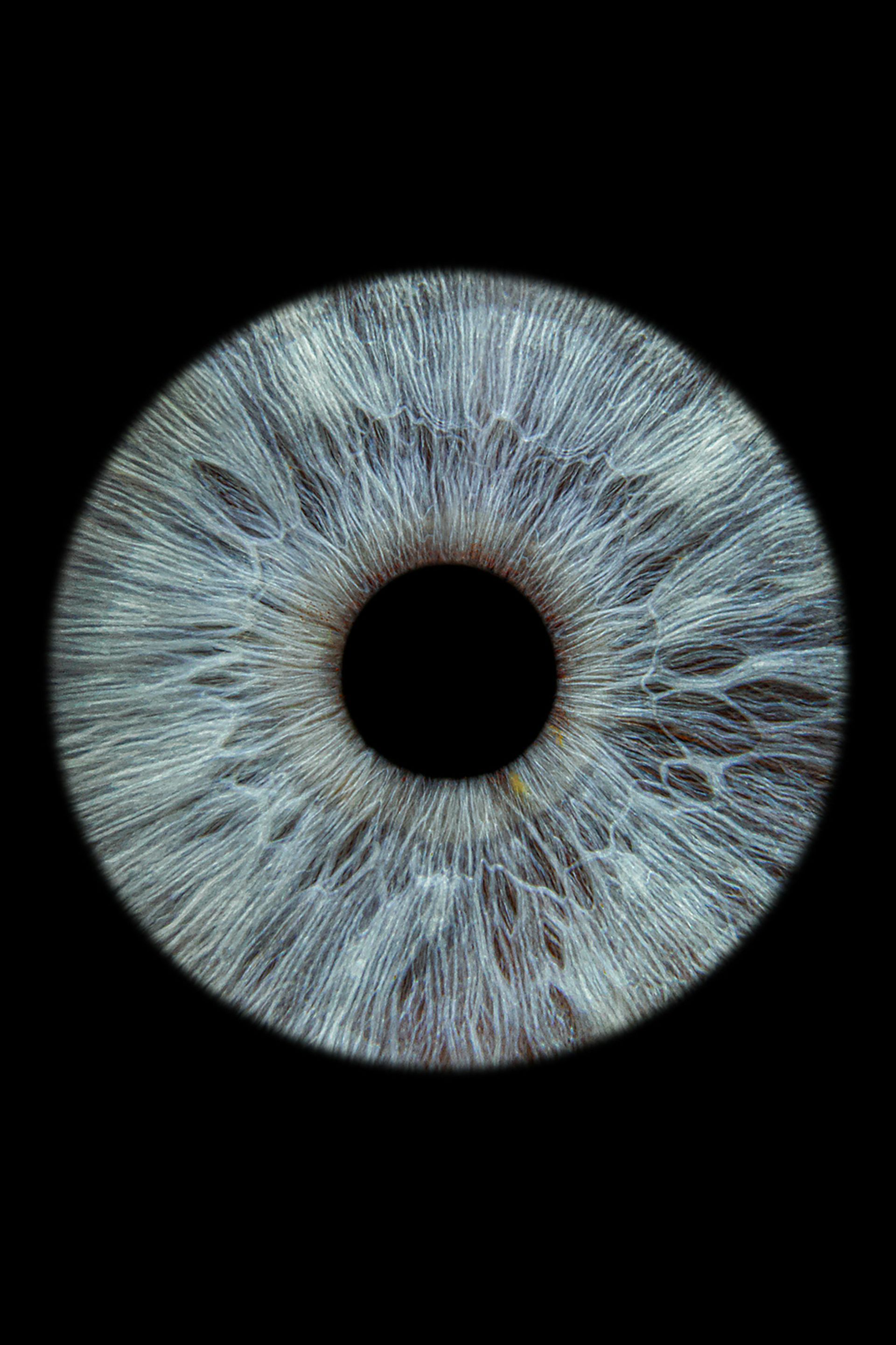 pupil (black center of eye) and iris (colored part of the eye)