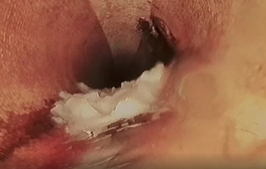 Roots at Cut Joint, TP Left Behind