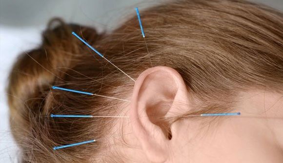 Acupuncture Can Treat Many Conditions Without Causing Complications