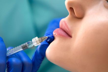 A woman is getting a botox injection in her lips.