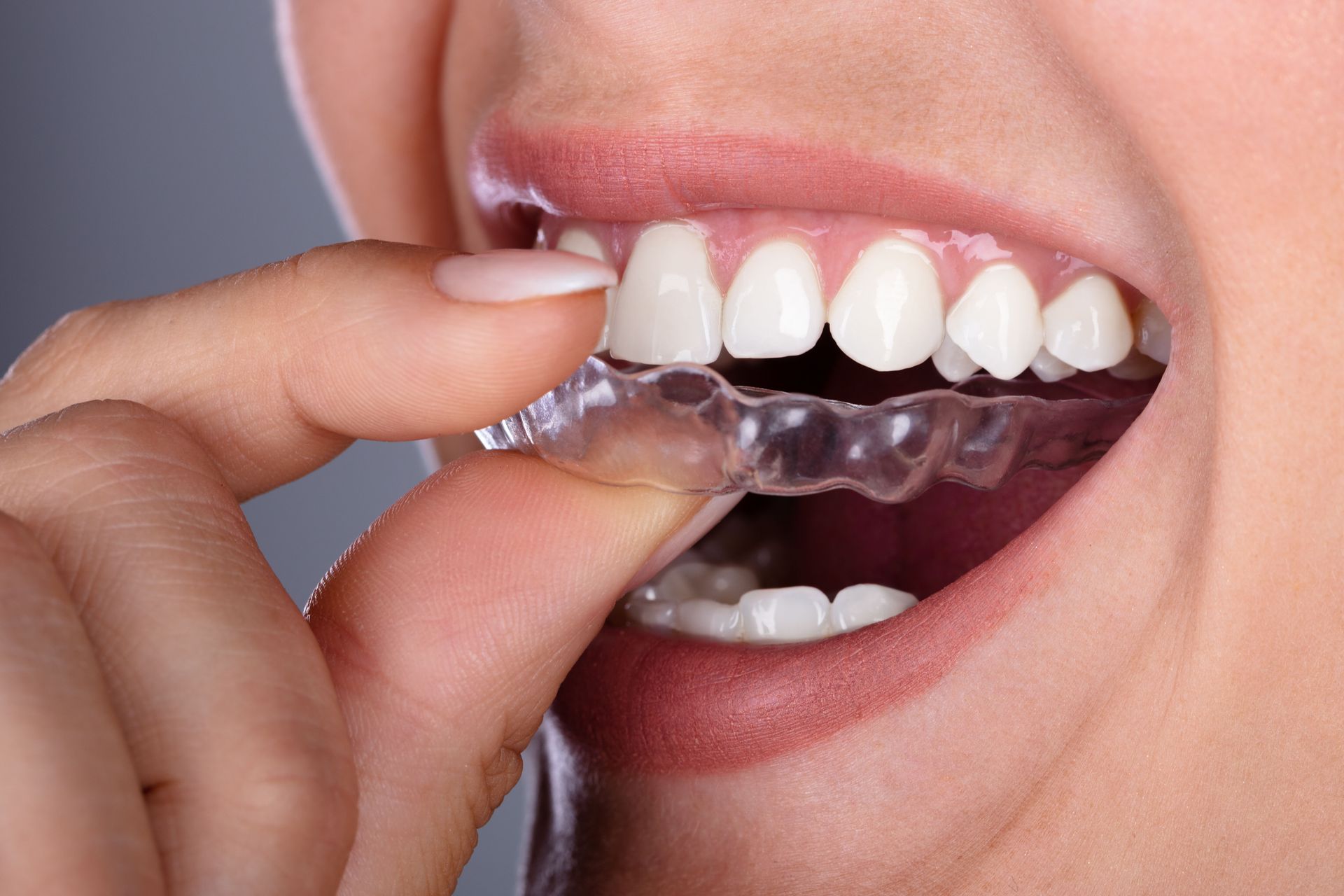 local orthodontists